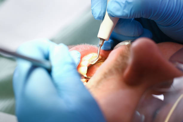 Best Dentist for Tooth Abscess  in Lehighton, PA